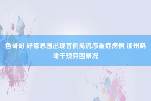 色哥哥 好意思国出现首例禽流感重症病例 加州晓谕干预穷困景况